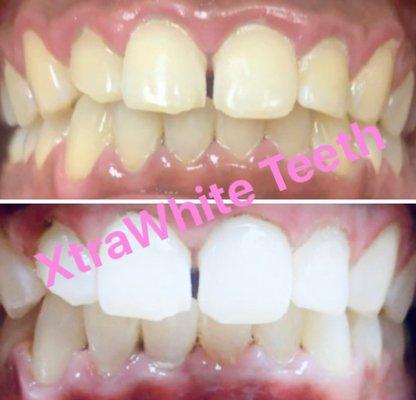 Book Whiter Teeth with Mina Billions