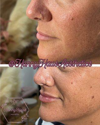 Hunnyhaus Aesthetics