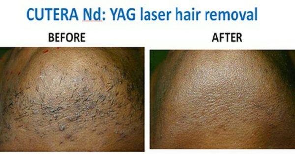 Aroma Spa and Laser Center