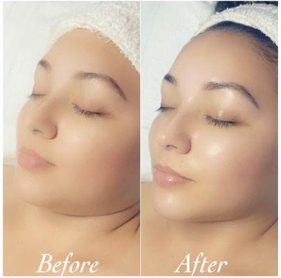 Glo skincare by Adella