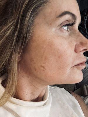 North Atlanta Plastic Surgery (NAPS) & The Spa at NAPS