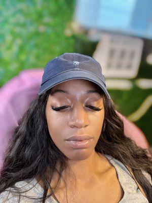 Before neutralization