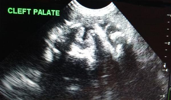 Ultrasound Imaging Options
