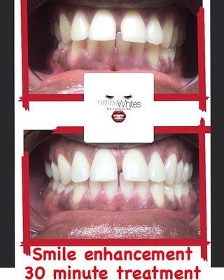 Milky Whites Cosmetic Bar