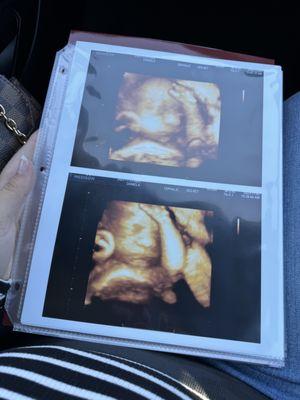 Prenatal Peek - 3D/4D Ultrasound