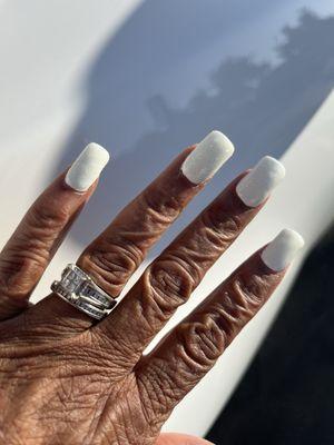 Product around the nail bed she tried to file it off