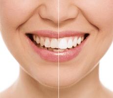 Selma Sunshine Dental