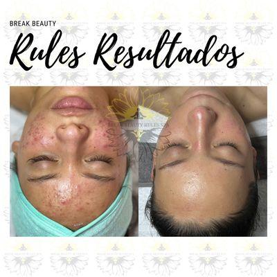 Break Beauty Rules Spa