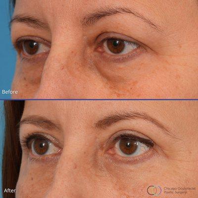 Paul Phelps, MD, FACS