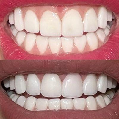 NH Dentistry Beverly Hills