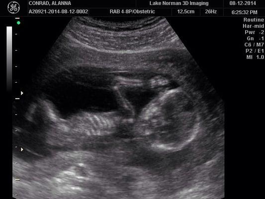 Lake Norman 3D Imaging