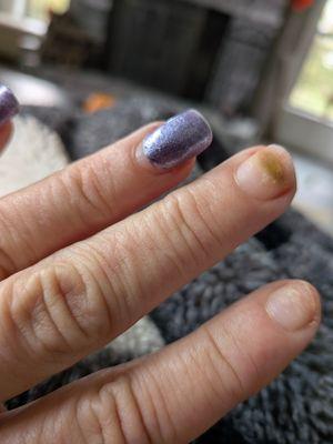 This is after 10days only