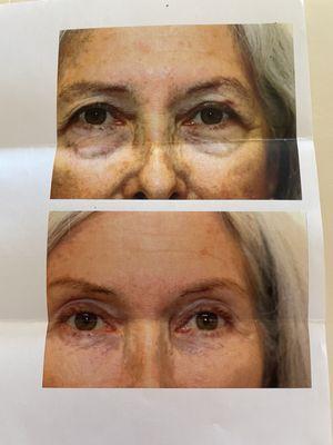 M. Polly McKinstry, M.D.