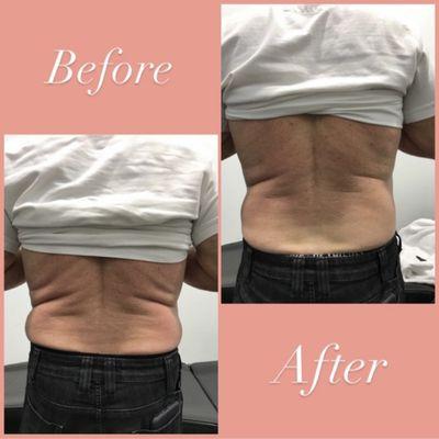 Eye Candy Body Sculpting