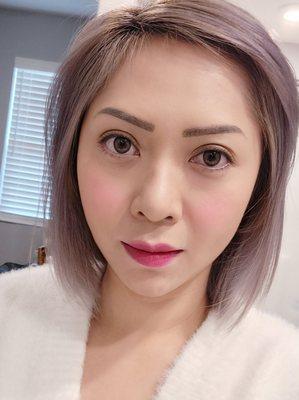 TMJ gets worst as I aged, 42 years old. Dr Singh always give the right amount. BOTOX also slim down my face and give that V- Shape.