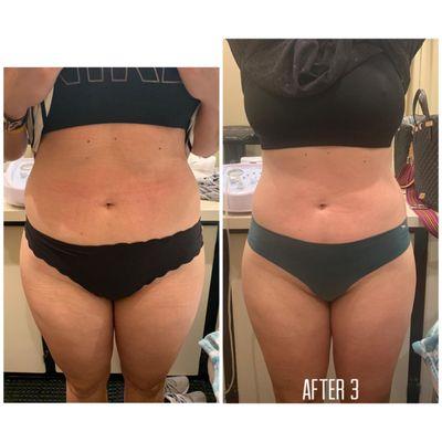 Chic Essentials Body