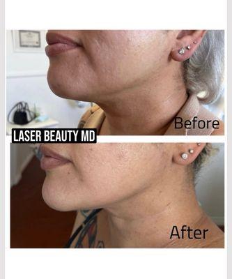 Laser beauty Med Spa