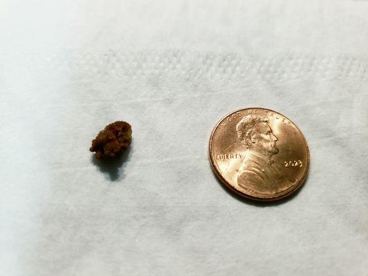 Upstate Community Hospital