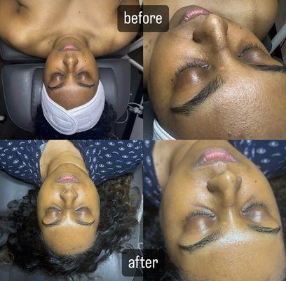 The magical CEO Facial