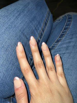 You can see the redness in my fingers because of how much he cut me