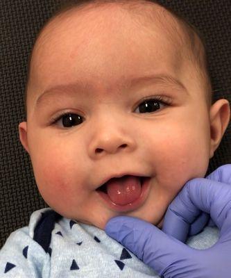 Center For Infant Tethered Oral Ties