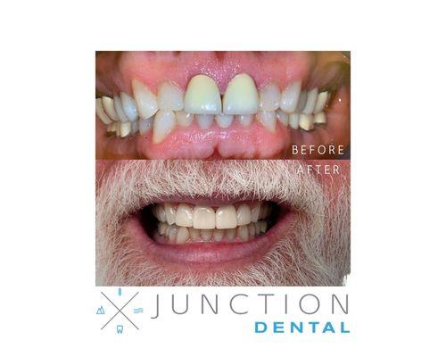 An example of successful outcomes we provide our patient!