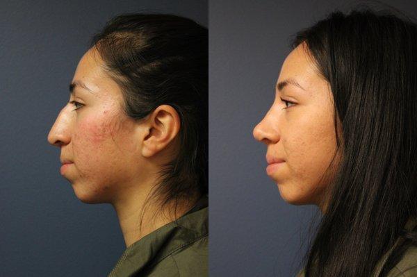 FacesFirst Cosmetic Surgery