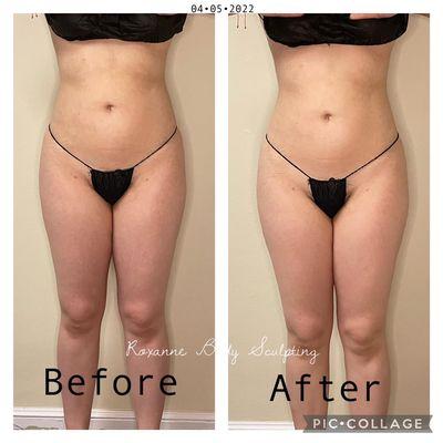 Enhanced Brazilian Slimming Massage - Full Body Treatment