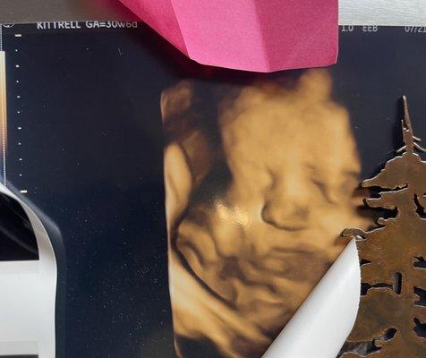 Baby Bloom 4D Ultrasound Studio