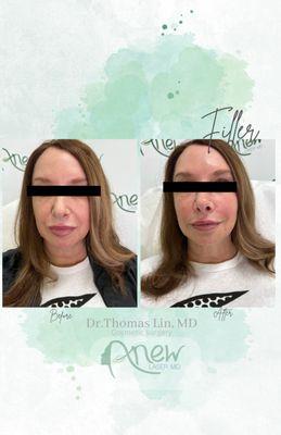 Anew Laser MD -Holistic Medicine Practitioner in Orange County