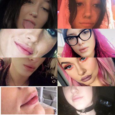 I showed him this collage of how I wanted my lips and he said it was impossible