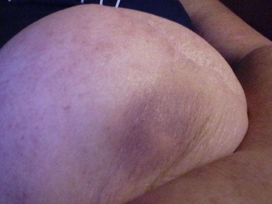 A manual wheelchair the one that I really need and they refused me said my insurance refuse me my insurance was was on a three-way wit Laura