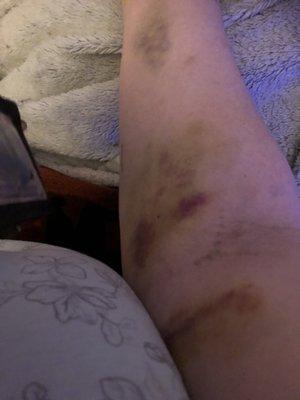 Phoebe Putney Memorial Hospital North Campus