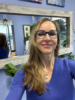 Before and after Treatment with Jamie at Injected artistry