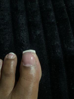 This is my big toe after two days, I told them I wanted acrylic because I know my nails are weak and since nobody knew how to do it.