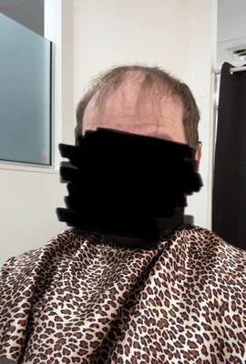 Angie's Hair Replacement