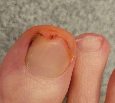 PA Foot & Ankle Associates