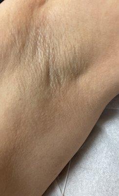 Underarm Wax