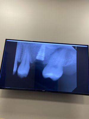 Murfreesboro Oral Surgery & Implant Cente