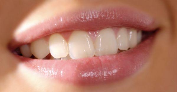 Smile For Success Dental Center - Tim Do Nha Khoa