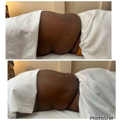 Massage Remedial Care