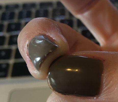 Jagged and raw cuticles.