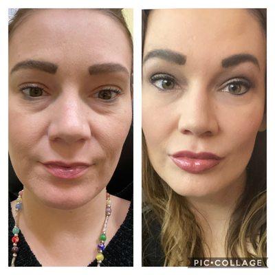 American Academy of Facial Esthetics