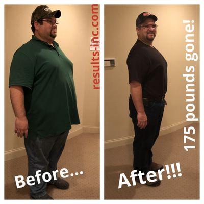 Results Weight Loss Centers - Canton