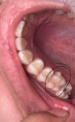 Open And Affordable Dental Englewood