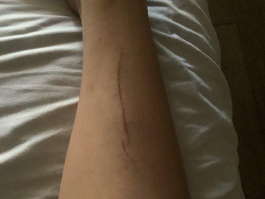 Physically assaulted