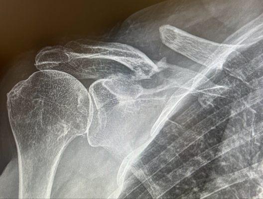 Henderson County Community Hospital