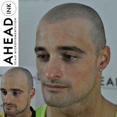 Scalp Micropigmentation SMP done at Ahead Ink in Fort Lee, New Jersey