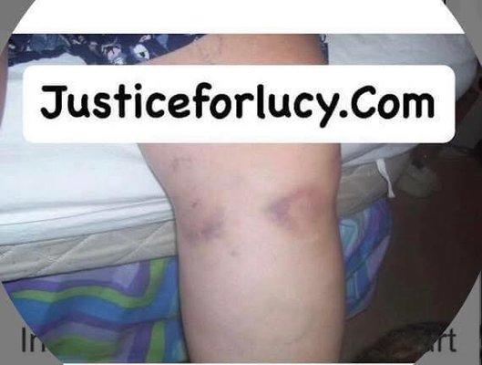 Injured at Smiths and abandoned.