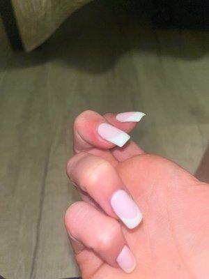 middle finger all swollen and red on the side.